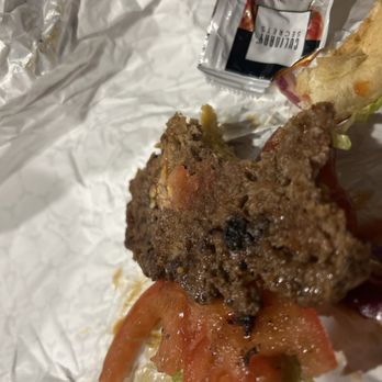 Big Burger - A hair in my Big Burger Combo - Burgers Near Me - Kansas City, Missouri Big Burger - A hair in my Big Burger Combo - Burgers Near Me - Kansas City, Missouri