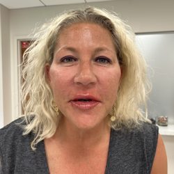 Intentional Wellness Medspa - Check fillers
