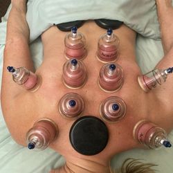 Allyvmassage - Cupping and hot stones!