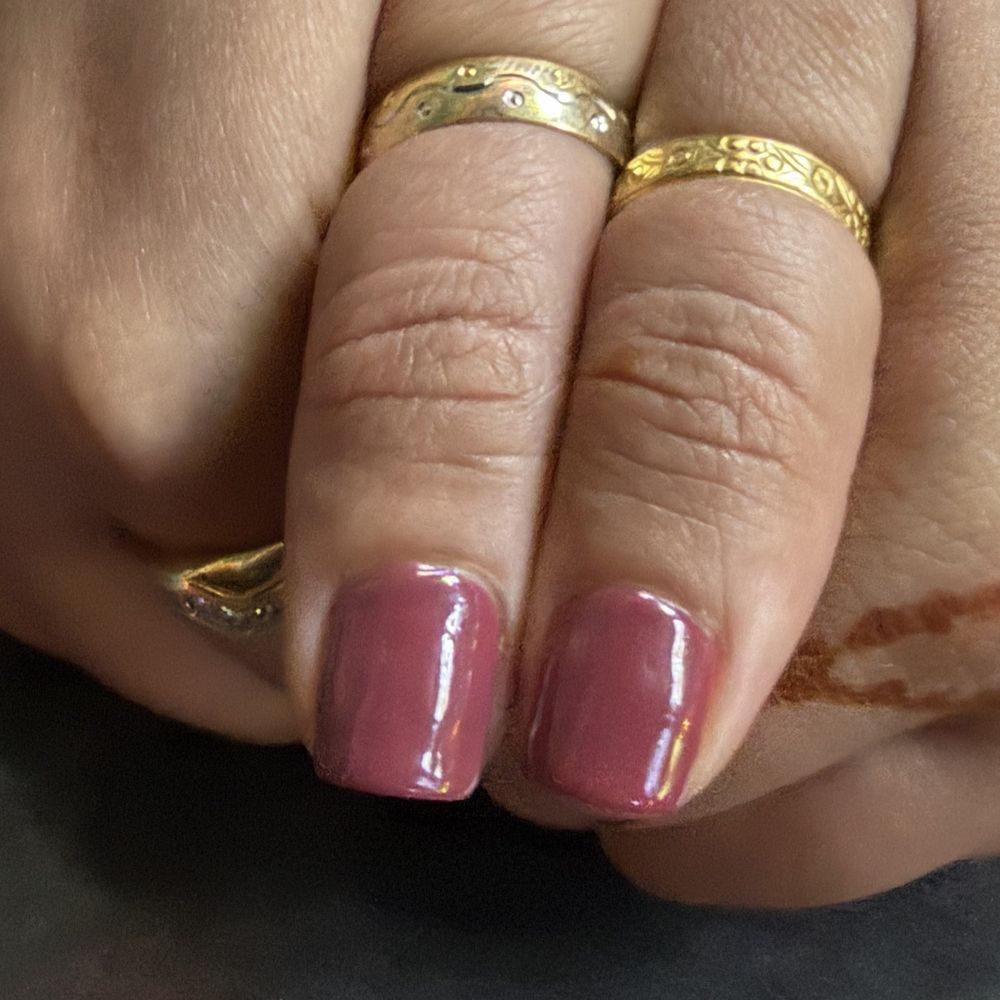 Uneven thumb nails