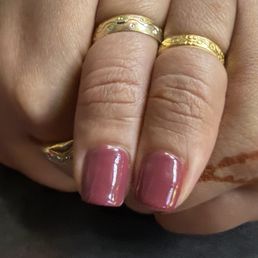 Uneven thumb nails Uneven thumb nails