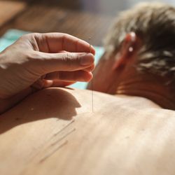 Aspen Acupuncture And Herbal Medicine - Aspen Acupuncture and Herbal Medicine, Moorhead, MN
