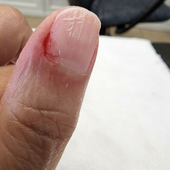 Maggie’s Beauty Max - Nail job gone bad, hope it doesn't get infected - Hair Salons Near Me - Milpitas, California Maggie’s Beauty Max - Nail job gone bad, hope it doesn't get infected - Hair Salons Near Me - Milpitas, California