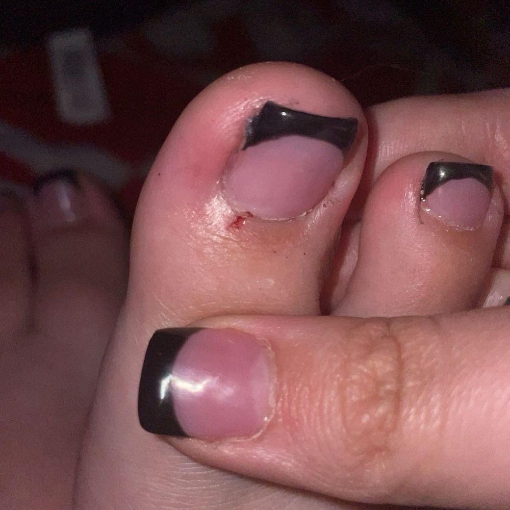 World Nails - Bleeding big toe - Nail Salons Near Me - Bay City, Michigan World Nails - Bleeding big toe - Nail Salons Near Me - Bay City, Michigan
