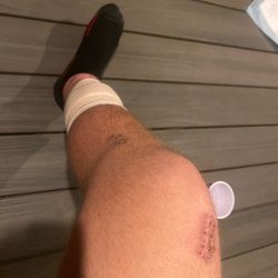 Hughston Orthopaedics - My right leg operated on by Dr. Mansour. Couldn't have asked for a smoother recovery.
