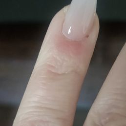 Really sore 3 days later Really sore 3 days later