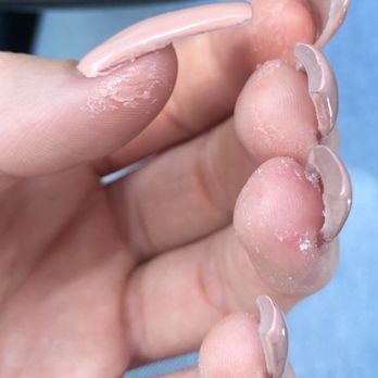 Fresh Nails & Spa - acrylic left all over. my ring finger and thumb was cut. - Nail Salons Near Me - Glendale, Arizona Fresh Nails & Spa - acrylic left all over. my ring finger and thumb was cut. - Nail Salons Near Me - Glendale, Arizona