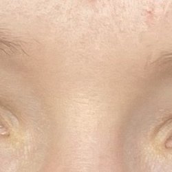 Angel Skin and Wax Studio - Before micro blading