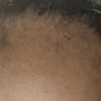 Glo Beauty Bar & Suites - This photo illustrates the direct application of black glue to my hair. - Hair Salons Near Me - Humble, Texas Glo Beauty Bar & Suites - This photo illustrates the direct application of black glue to my hair. - Hair Salons Near Me - Humble, Texas