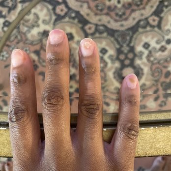 Gloss Nail Bar - Pinky and ring finger of right hand have a fungal infection. - Nail Salons Near Me - Houston, Texas