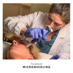 Emily Keaty Acupuncture - It uses thin needles to make tiny holes in the top layer of your skin it helps produces more collagen and elastin.