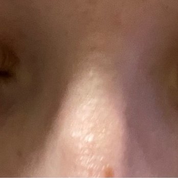 Amazing Lash Studio - Left eye over processed. - Eyelash Service Near Me - Cypress, Texas