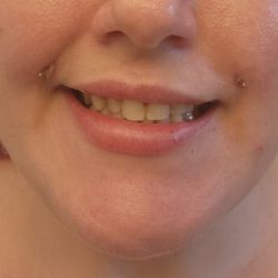 Bellissima Medical Aesthetics