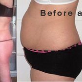 b12 lipo injections san antonio Lipo-B Injection main image 1