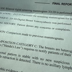 Medx Imaging and Eve's Breast Center - "Denies any concerns or complaints."