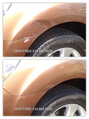 Photo of DentFree - San Leandro, CA, US.