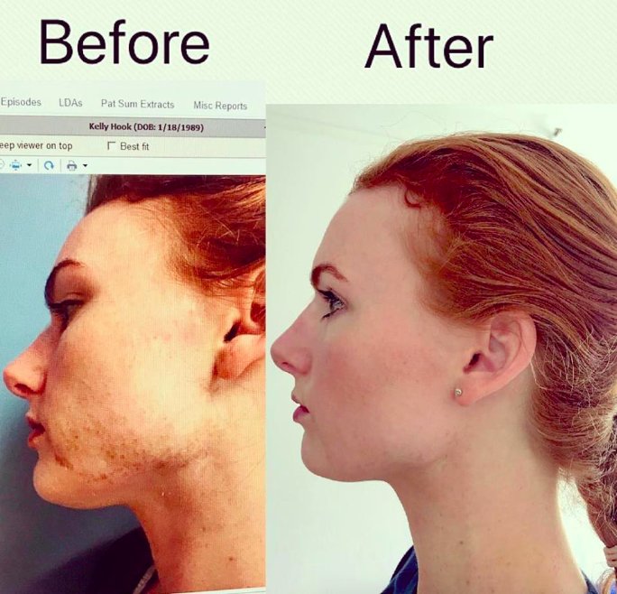 UCSF DERMATOLOGY CLINIC AT MT ZION Updated October 2024 116 Reviews