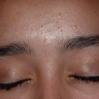 Threading By Shanaz - Stephanie before brow threading - Threading Services Near Me Threading By Shanaz - Stephanie before brow threading - Threading Services Near Me