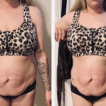Snatched BodyWorks - Body Contouring Near Me - Burleson, Texas Snatched BodyWorks - Body Contouring Near Me - Burleson, Texas