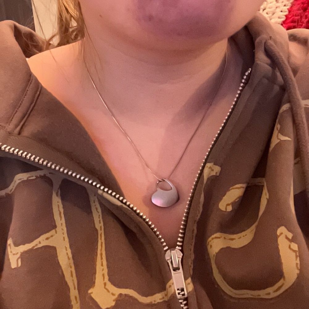Advanced Oakdale Dental - Bruising left from suction funnel - General Dentistry Near Me - Dedham, Massachusetts