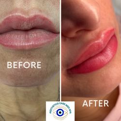 Aesthetics Care Med Spa
