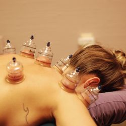 Massage Intuition - Cupping Therapy is a great approach to relieve muscle tension