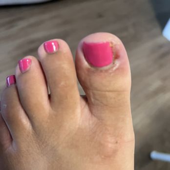 XO Nails & Spa - A week after the pedicure - Nail Salons Near Me - La Habra, California XO Nails & Spa - A week after the pedicure - Nail Salons Near Me - La Habra, California