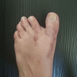 Franklin Foot Care of Rhode Island