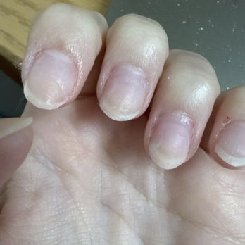 Royal Nails - Can tell the acrylic is still on - Nail Salons Near Me - Wayne, Nebraska Royal Nails - Can tell the acrylic is still on - Nail Salons Near Me - Wayne, Nebraska