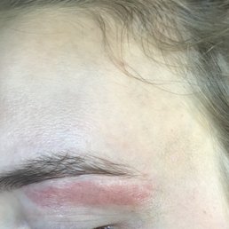 22 hours post wax 22 hours post wax