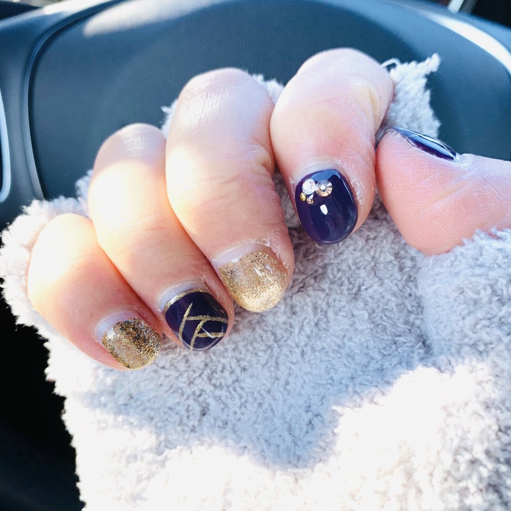 One week after nail was done. One week after nail was done.