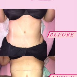Bodied By Shelly - Before & After Customized Body Sculpting Session