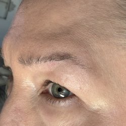 Vitiello Primary Care - After treatment