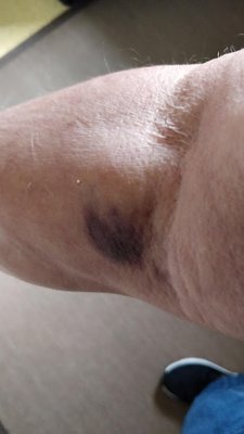 LABCORP - Updated January 2026 - 21 Photos & 52 Reviews - 5860 Owens Dr ...