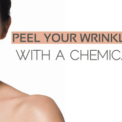 Divine Serendipity Day Spa - Glycolic Acid , Salicylic Acid, and TCA Peels Offered