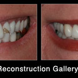 Laura Wittenauer DDS - Studio Dentistry - Dental Before & After Gallery http://studiodentistry.com/photo-gallery/
