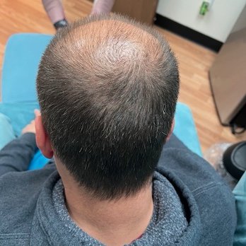 Mind & Body Rejuvenation Clinic - Picture taken by Danielle at her facility. - Hair Loss Centers Near Me - Temecula, California