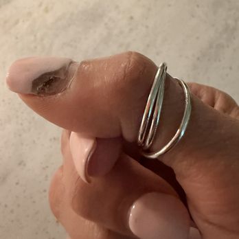 Noire Nail Bar - Fungus in nail - Nail Salons Near Me - Naples, Florida Noire Nail Bar - Fungus in nail - Nail Salons Near Me - Naples, Florida