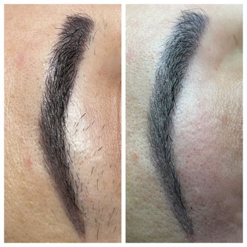 Electrolysis by Anna - Hair Removal Near Me - Glendale , California Electrolysis by Anna - Hair Removal Near Me - Glendale , California
