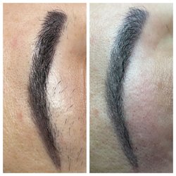 Electrolysis by Anna