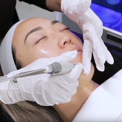 Karyne and Company Day Spa - The ULTIMATE Facial Treatment - Hydrafacial