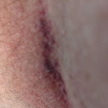 LABCORP - Updated February 2026 - 10 Photos & 48 Reviews - 620 Cranbury ...