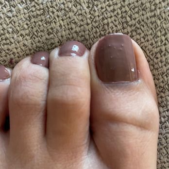 Nailpolish - Bumps on the big toe - Nail Salons Near Me - Long Beach, California Nailpolish - Bumps on the big toe - Nail Salons Near Me - Long Beach, California