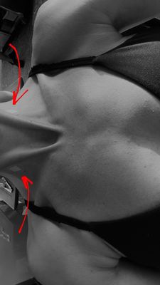 Extension Health by null