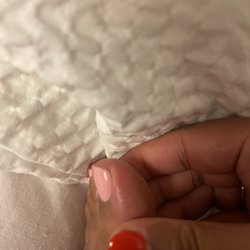Gelish Nails - The swelling that's throbbing