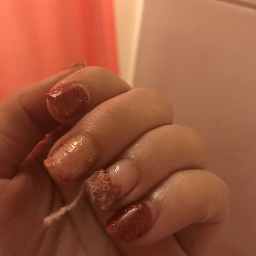 Vida Nails & Spa - Removal of set done by Vida less than 2 weeks after getting a $65 new set - Nail Salons Near Me - Warwick, Rhode Island Vida Nails & Spa - Removal of set done by Vida less than 2 weeks after getting a $65 new set - Nail Salons Near Me - Warwick, Rhode Island