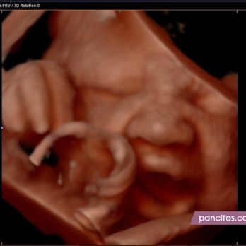 Pancita's - Diagnostic Imaging Near Me - Davie, Florida