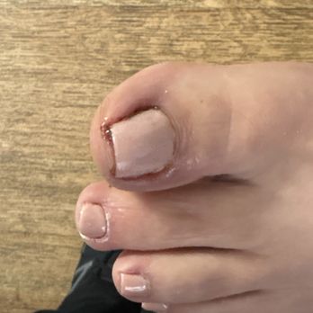 Central Nails - This is the third time my mother's toes infected. They do not clean or sanitize their tools! - Nail Salons Near Me - Garden Grove, California Central Nails - This is the third time my mother's toes infected. They do not clean or sanitize their tools! - Nail Salons Near Me - Garden Grove, California