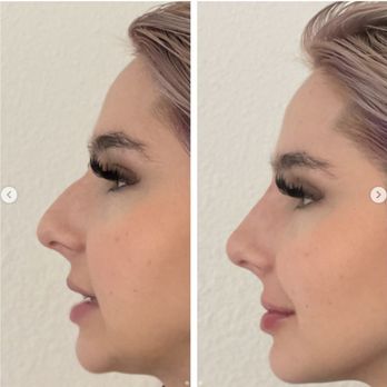 Anastology - Laser Hair Removal Near Me Anastology - Laser Hair Removal Near Me