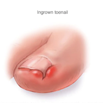 Amir Lebaschi, DPM - Podiatrists Near Me - Santa Ana, California
